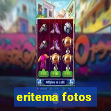 eritema fotos