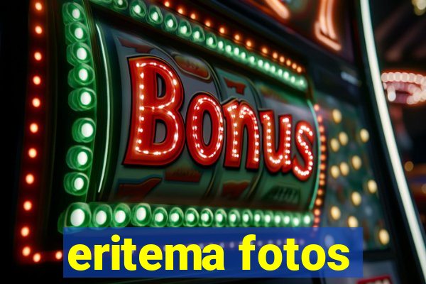 eritema fotos