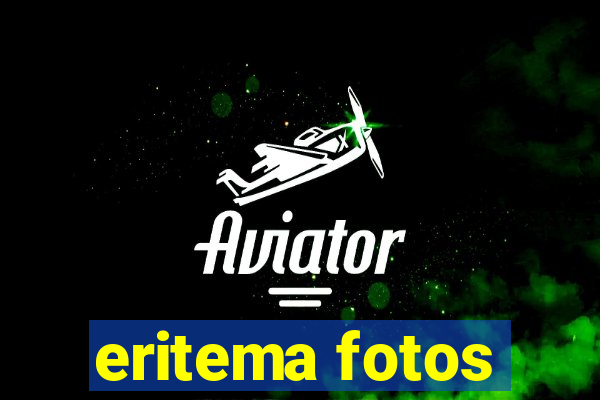eritema fotos